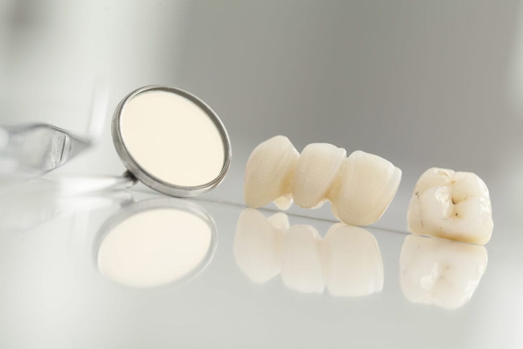 Dental Inlay & Onlay Thornton, CO