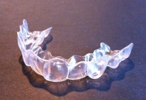 At Home Orthodontics Recommendations